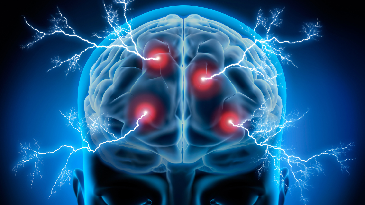 Dopamine's Reach Into the Primate Parietal Attention Network
