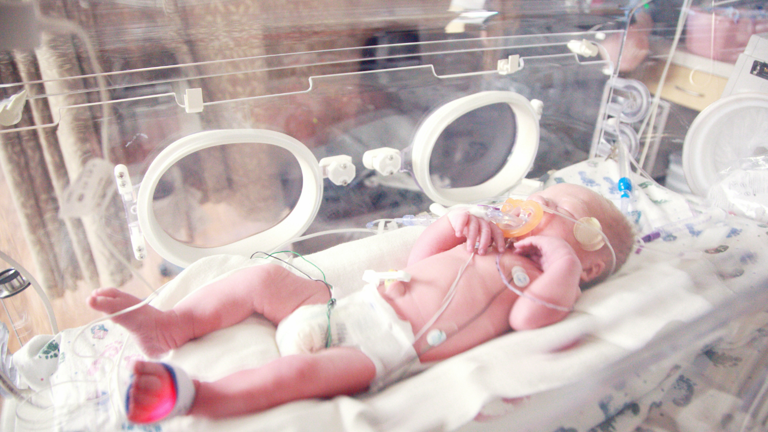 Why Platinum/Iridium 90:10 Was Chosen for a Neonatal Sweat Glucose Biosensor