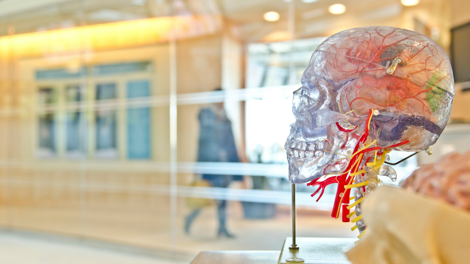 Early Brain Changes in Huntington’s Disease: New Study Uses Advent Research Materials in Breakthrough Findings